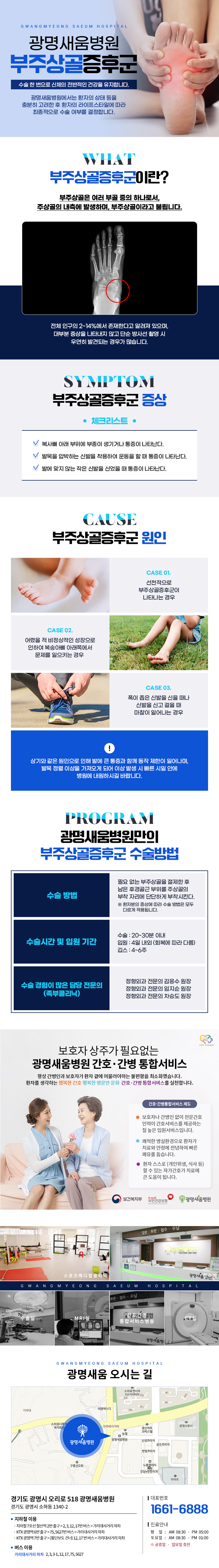 무지외반증