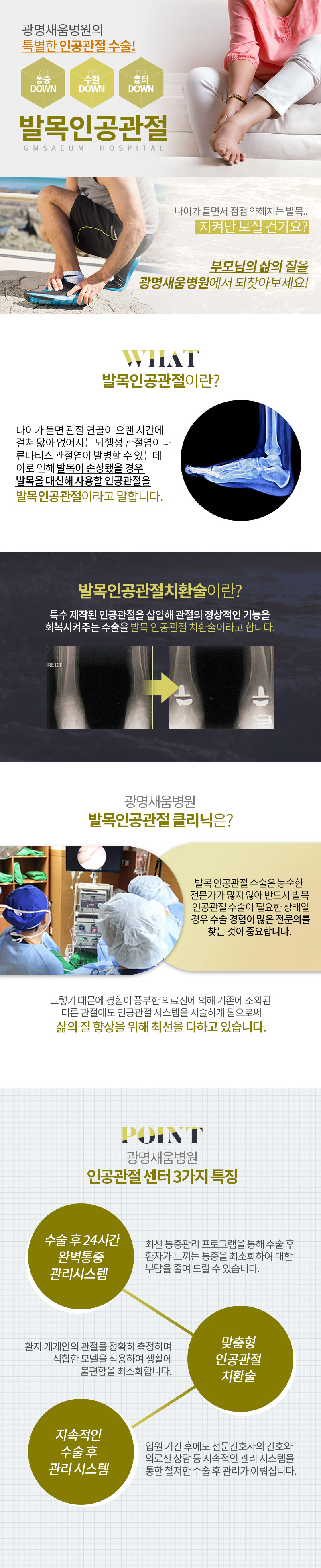 인공관절치환술